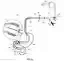Fig. 20 - External anchoring configurations for modular gastrointestinal prostheses