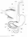 Fig. 25 - External anchoring configurations for modular gastrointestinal prostheses