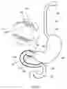 Fig. 26 - External anchoring configurations for modular gastrointestinal prostheses