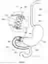 Fig. 27 - External anchoring configurations for modular gastrointestinal prostheses