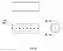 Fig. 35 - External anchoring configurations for modular gastrointestinal prostheses