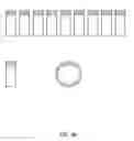 Fig. 46 - External anchoring configurations for modular gastrointestinal prostheses
