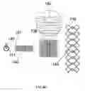 Fig. 49 - External anchoring configurations for modular gastrointestinal prostheses