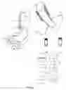 Fig. 53 - External anchoring configurations for modular gastrointestinal prostheses