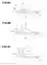 Fig. 08 - Endoscope insertion apparatus