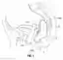 Fig. 02 - Apparatus and method for transvaginal surgery