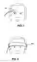Fig. 02 - Forehead sensor placement