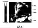 Fig. 07 - Forehead sensor placement