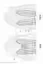 Fig. 09 - Medical electrode, electrode bundle and electrode bundle array