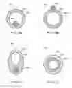 Fig. 09 - METHOD AND APPARATUS FOR DERMATOLOGICAL TREATMENT AND TISSUE RESHAPING