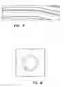 Fig. 05 - Endovascular Optical Coherence Tomography Device