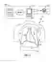 Fig. 02 - SYSTEM AND METHODS FOR PULMONARY EDEMA DETECTION WITH IMPLANTABLE ACOUSTIC DEVICES