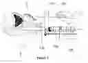 Fig. 04 - TRANSPERINEAL PROSTATE BIOPSY SYSTEM AND METHODS
