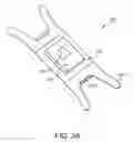 Fig. 03 - Subcutaneous access device and related methods