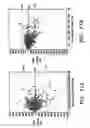 Fig. 13 - Noninvasive method and system for measuring pulmonary ventilation