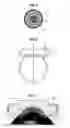 Fig. 04 - High intensity focused ultrasound device and method for ocular pathology treatment