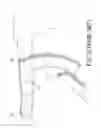 Fig. 03 - Compression device for medical treatment