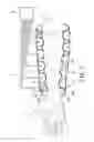 Fig. 09 - Compression device for medical treatment