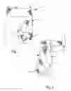 Fig. 02 - Hip brace apparatus and method of use