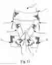 Fig. 07 - Hip brace apparatus and method of use