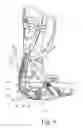Fig. 05 - Support shell arrangement for arrangement at a lower leg