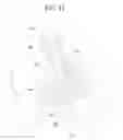 Fig. 34 - Renal therapy system having pump reversing fluid control