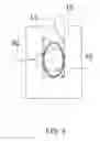 Fig. 05 - Dialysis systems including non-invasive multi-function sensor systems