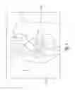 Fig. 03 - TAMPON ASSEMBLY PROVIDING PROPER BODILY PLACEMENT OF A PLEDGET