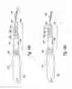 Fig. 19 - TAMPON ASSEMBLY PROVIDING PROPER BODILY PLACEMENT OF A PLEDGET