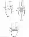 Fig. 02 - Device and methods for delivery and transfer of temporary radiopaque element