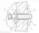 Fig. 01 - Extensible internal bolster for a medical device