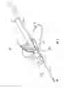 Fig. 02 - Non-axial return spring for safety needle