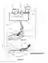 Fig. 07 - Wound cleansing apparatus with heat