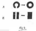 Fig. 04 - Vacuum assisted wound dressing