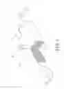 Fig. 02 - Negative pressure bandage
