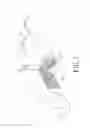 Fig. 06 - Negative pressure bandage