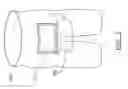 Fig. 05 - System and method for post-operative care for a liposuction procedure