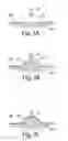 Fig. 04 - SYSTEMS AND METHODS FOR CREATING AND USING SUCTION BLISTERS OR OTHER POOLED REGIONS OF FLUID WITHIN THE SKIN