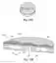 Fig. 08 - SYSTEMS AND METHODS FOR CREATING AND USING SUCTION BLISTERS OR OTHER POOLED REGIONS OF FLUID WITHIN THE SKIN