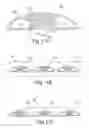 Fig. 09 - SYSTEMS AND METHODS FOR CREATING AND USING SUCTION BLISTERS OR OTHER POOLED REGIONS OF FLUID WITHIN THE SKIN