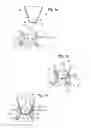 Fig. 02 - Apparatus for cutting a tissue section of an eye by laser radiation