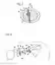 Fig. 03 - BONE FIXATION USING AN INTRAMEDULLARY PIN