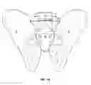 Fig. 02 - Transiliac-transsacral method of performing lumbar spinal interventions