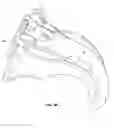 Fig. 03 - Transiliac-transsacral method of performing lumbar spinal interventions
