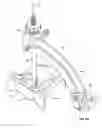 Fig. 14 - Transiliac-transsacral method of performing lumbar spinal interventions