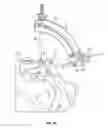 Fig. 16 - Transiliac-transsacral method of performing lumbar spinal interventions