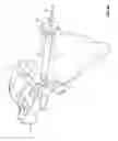 Fig. 19 - Transiliac-transsacral method of performing lumbar spinal interventions