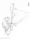 Fig. 20 - Transiliac-transsacral method of performing lumbar spinal interventions