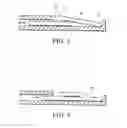 Fig. 03 - Apparatus for spinal fusion