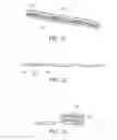 Fig. 10 - Apparatus for spinal fusion